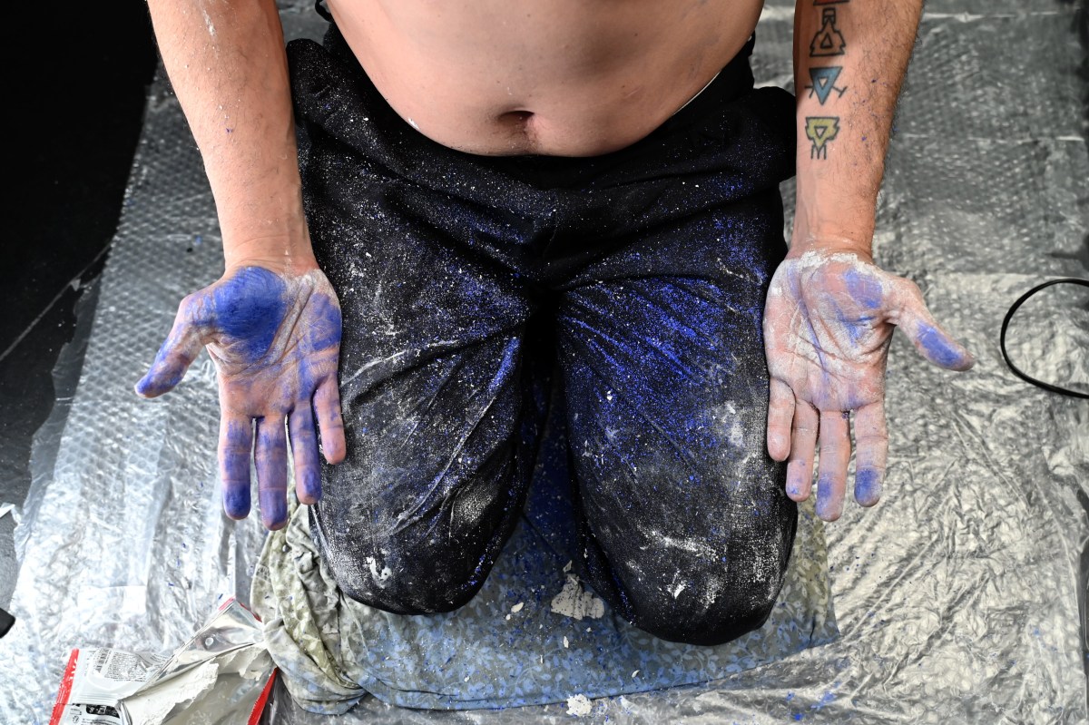 tessuto: epiteliale, connettivale, stromale – Roccioletti